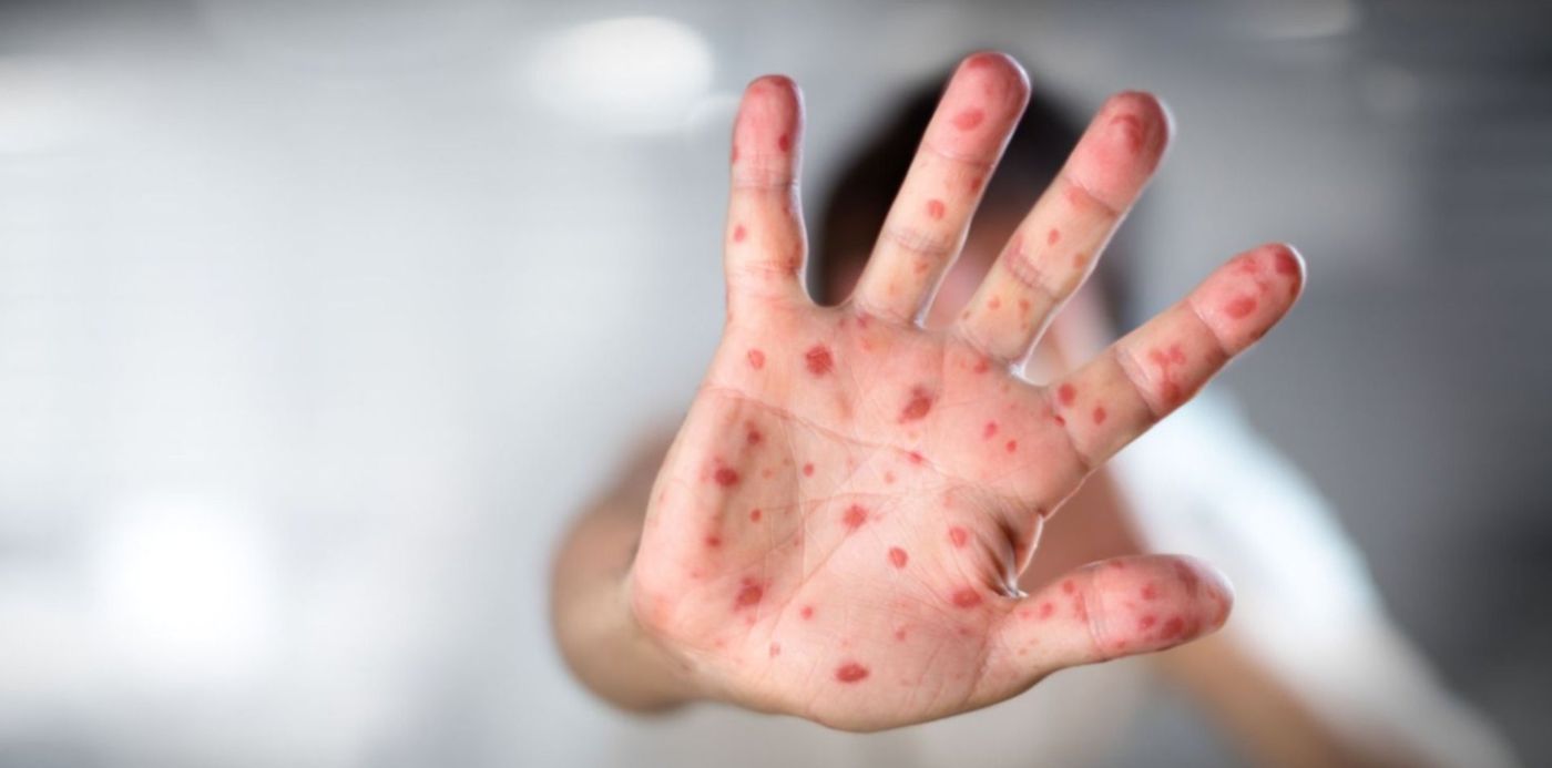 1657672759061.jpg?x=6&y=43&width=1488&height=744&rotate=0&scaleX=1&scaleY=1&ow=1500&oh=843&&cw=1920&ch=950