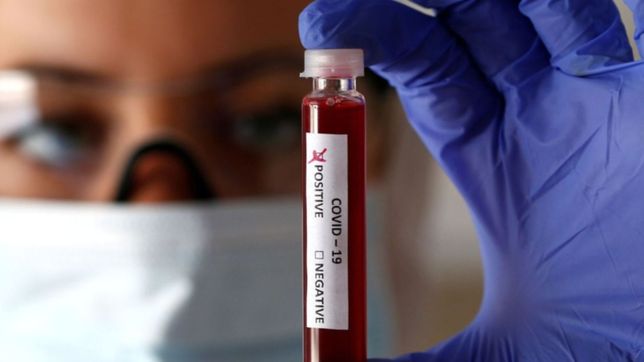 ¿por que algunos grupos sanguineos tienen mas chances de contagiarse de covid-19?