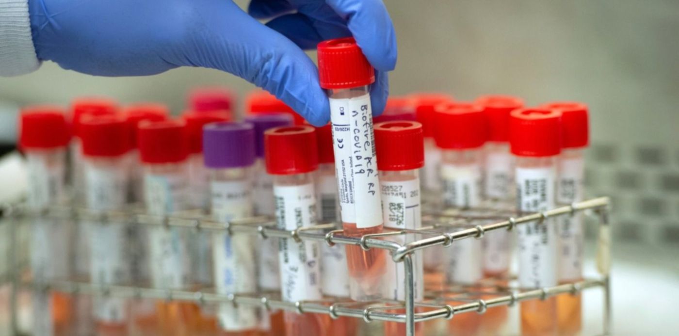 1585424745790.jpeg?x= 15&y=61&width=1530&height=765&rotate=0&scaleX=1&scaleY=1&ow=1500&oh=968&&cw=1920&ch=950