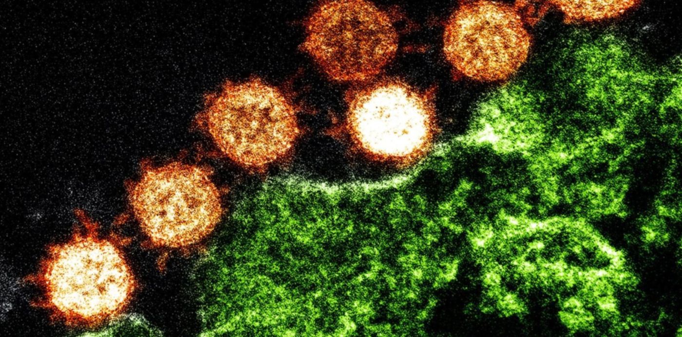 1580068416397.jpg?x=13&y=200&width=1474&height=736&rotate=0&scaleX=1&scaleY=1&ow=1500&oh=999&&cw=1920&ch=950