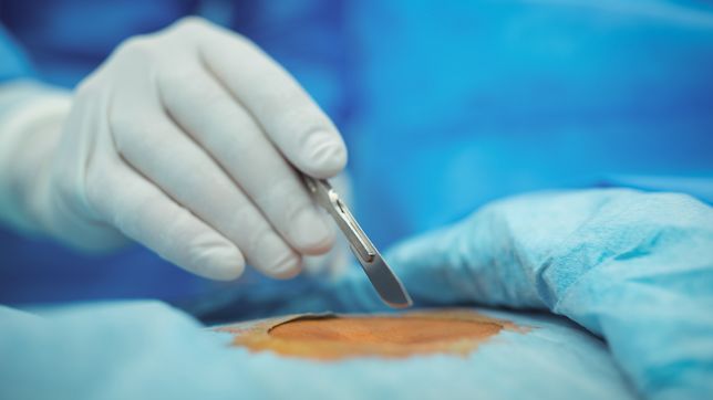 anestesistas suspenden cirugias programadas en la plata por un conflicto con ioma