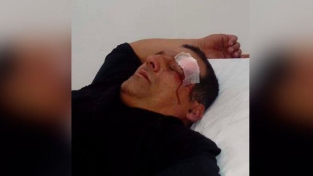 un empleado municipal de ensenada desfiguro a un vecino en medio de una discusion