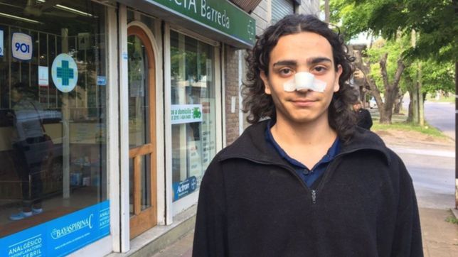 lo acusaron de intentar secuestrar mujeres, le rompieron el tabique y busca a su agresor