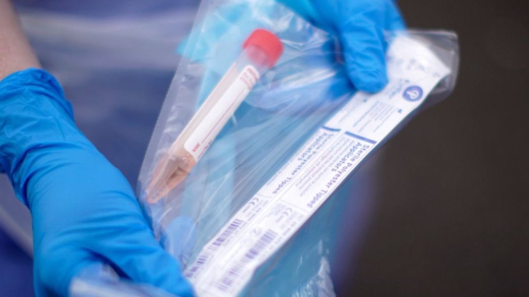 Secco confirmó que el hombre que murió en Ensenada no tenía coronavirus