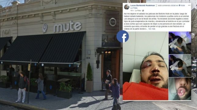 el joven que fue atacado por patovicas de mute y casi pierde un ojo ya hizo la denuncia
