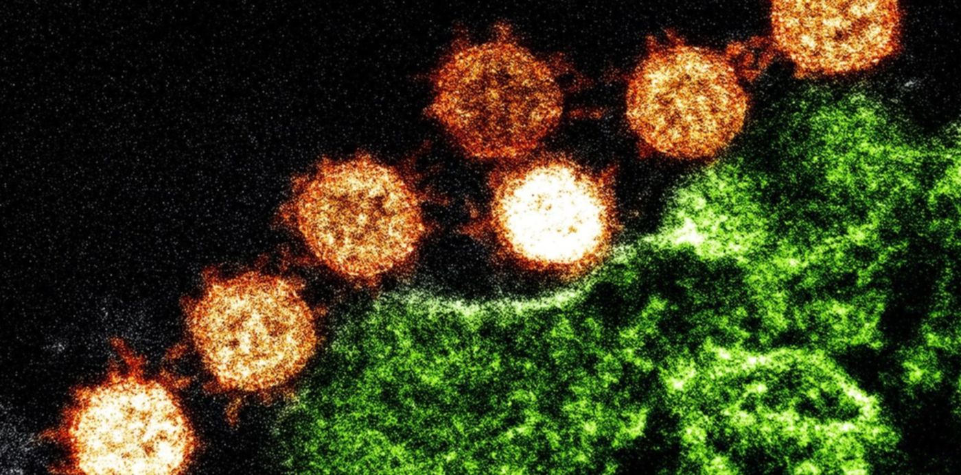 1580068416397.jpg?height=743&rotate=0&scaleY=1&ow=1500&x=3&y=130&width=1486&scaleX=1&oh=999&&cw=1920&ch=950