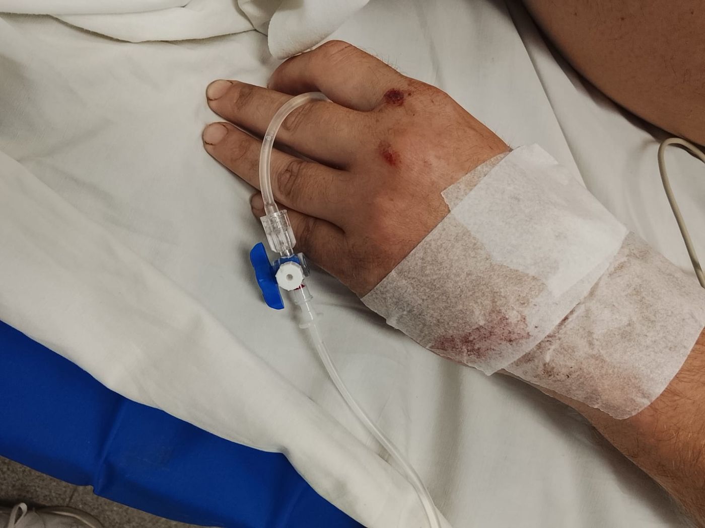 Internado en el Hospital San Martín de La Plata, el hombre presenta un grave sangrado cerebral