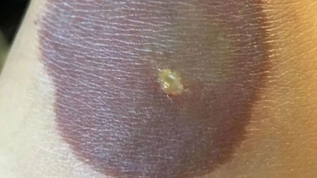 una nena hizo un reto viral de tik tok y ahora debe operarse: fueron 10 segundos