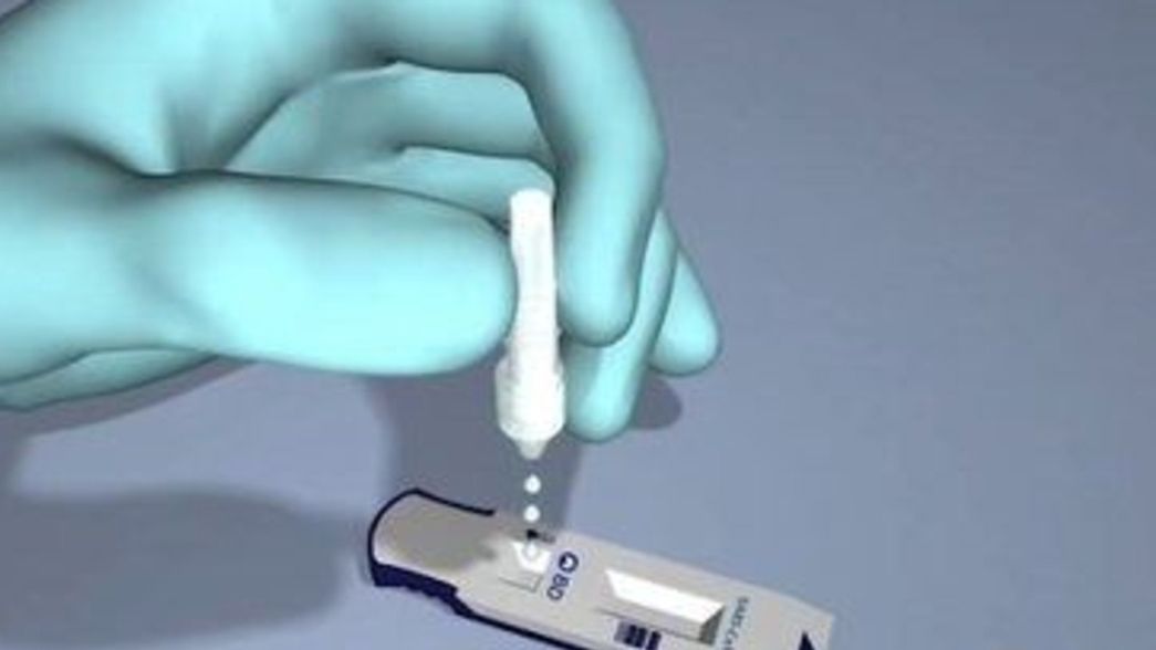 Cómo es el test aprobado por la ANMAT que permite diagnosticar COVID-19 en sólo 15 minutos