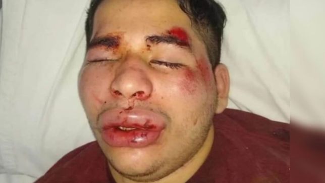 golpearon brutalmente a un joven y aseguran que ?fue por ser un rugbier?
