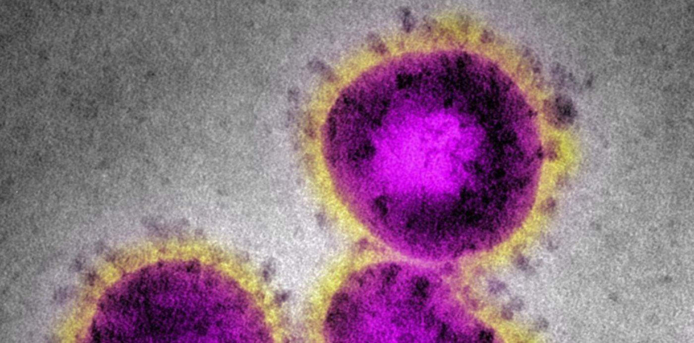 1596550536936.jpg?x=7&y=84&width=1186&height=593&rotate=0&scaleX=1&scaleY=1&ow=1199&oh=972&&cw=1920&ch=950