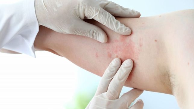 hablemos de dermatologia: charla gratuita de pami la plata sobre cuidado de la piel en adultos mayores