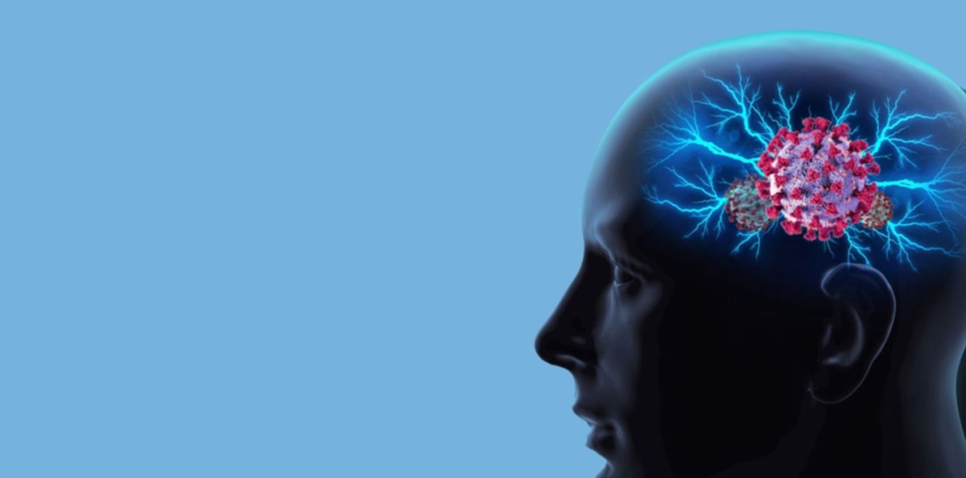 1593647360652.jpg?x=43&y=34&width=1450&height=725&rotate=0&scaleX=1&scaleY=1&ow=1500&oh=843&&cw=1920&ch=950