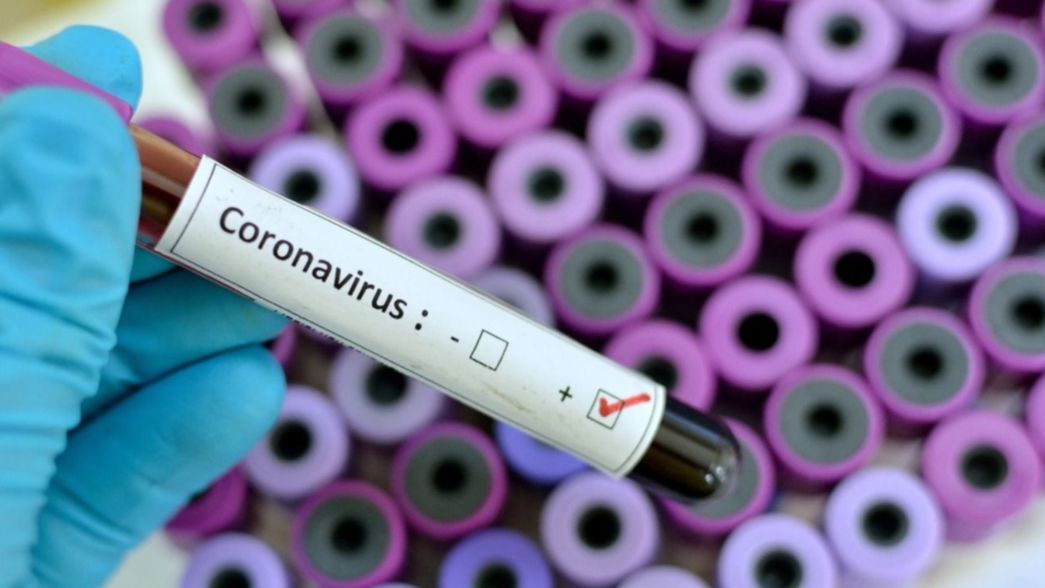 Confirmaron 11 nuevos casos de coronavirus y hay 40 pacientes infectados en Argentina