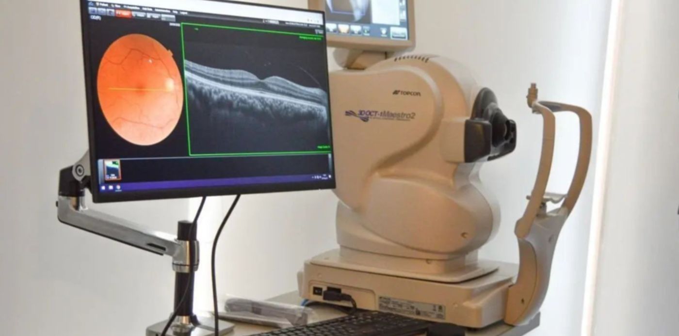 tomógrafos ópticos