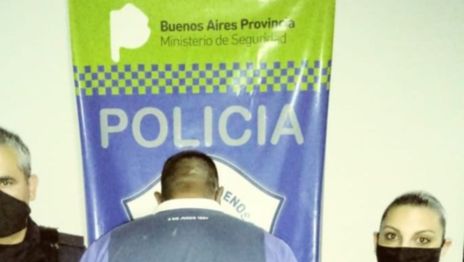 Detuvieron a un hombre en La Plata que le desfiguró la cara a su hijastra