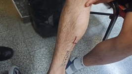 asaltaron a un vecino de la plata y lo balearon en una pierna para intentar robarle la moto asaltaron a un vecino de la plata y lo balearon en una pierna para intentar robarle la moto