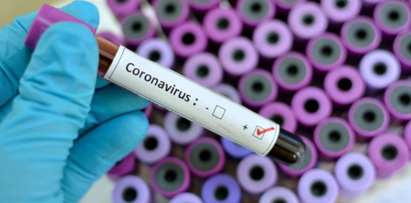 1582779577349.jpg?x=4&width=1491&rotate=0&scaleY=1&oh=993&y=177&height=746&scaleX=1&ow=1500&&cw=1920&ch=950