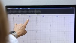 expertos de la unlp buscan mejorar los marcapasos implantables expertos de la unlp buscan mejorar los marcapasos implantables