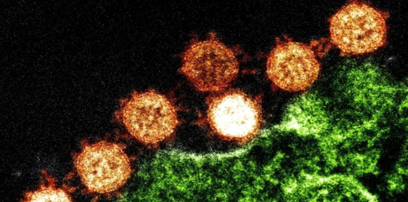 1610642563413.jpg?x=27&y=10&width=1455&height=727&rotate=0&scaleX=1&scaleY=1&ow=1500&oh=742&&cw=1920&ch=950