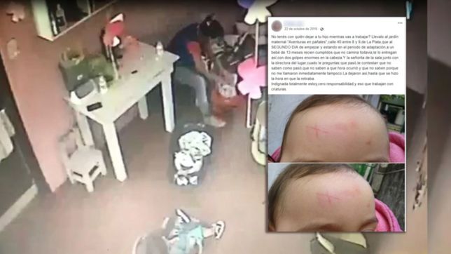 otra madre ya habia denunciado al jardin con una foto de su beba golpeada y cortada