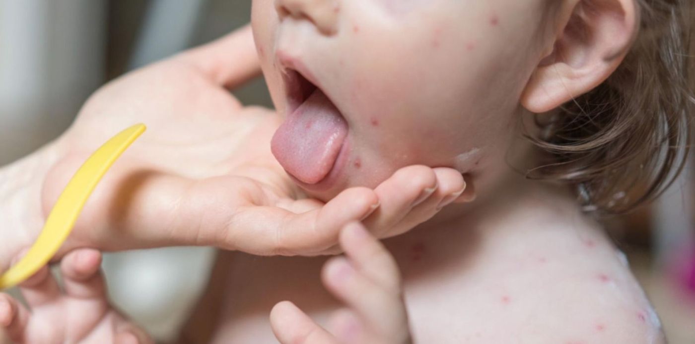 1650233289667.jpeg?x=9&y=3&width=1482&height=741&rotate=0&scaleX=1&scaleY=1&ow=1500&oh=843&&cw=1920&ch=950