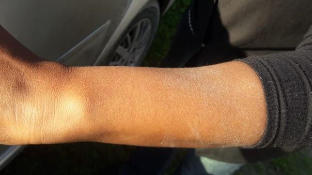 ¿como fue la agresion de la esposa y el custodio de berni a una mujer en ensenada?