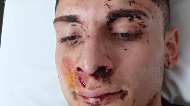 dos amigos de 19 anos fueron desfigurados a golpes en una fiesta en la plata