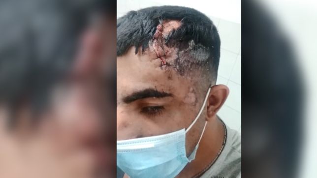 video: asi quedo el motociclista que fue chocado por piparo y su esposo en la plata