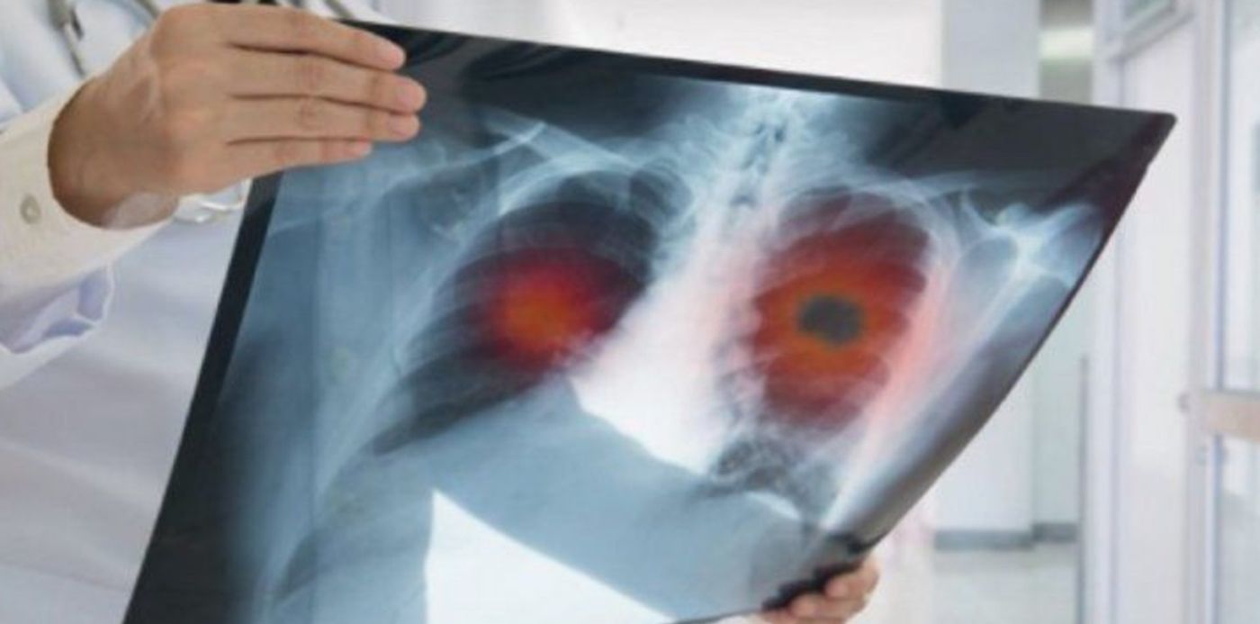 1623161958850.jpg?x=10&y=7&width=713&height=356&rotate=0&scaleX=1&scaleY=1&ow=730&oh=387&&cw=1920&ch=950