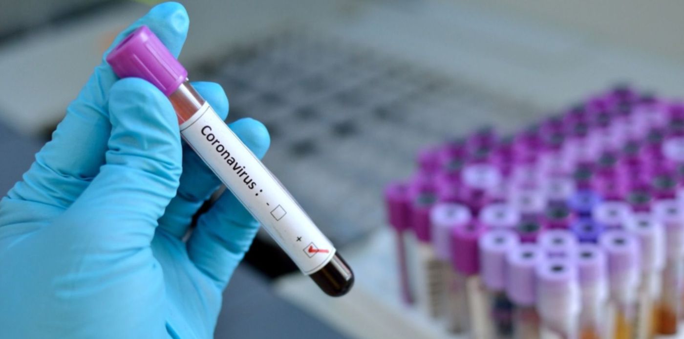 1584104954298.jpg?y=3&width=1489&height=744&scaleX=1&ow=1500&x=8&rotate=0&scaleY=1&oh=849&&cw=1920&ch=950