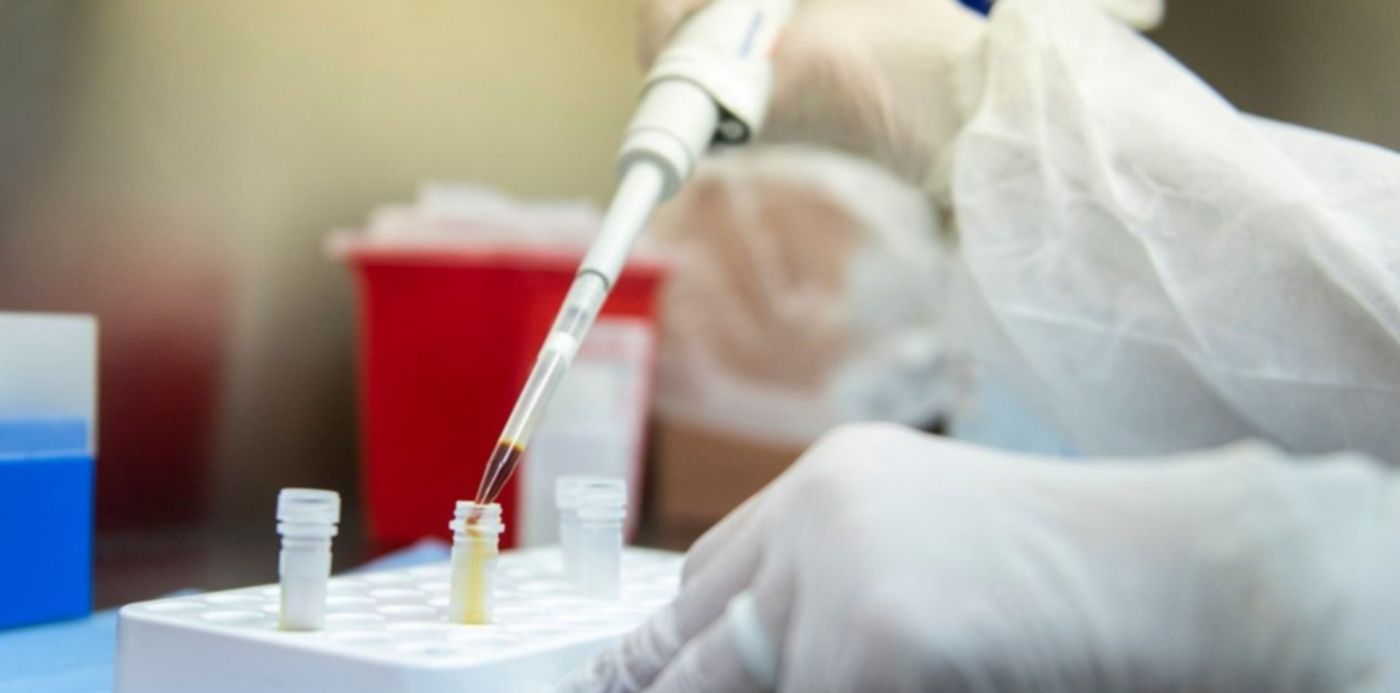 1585350783098.jpg?width=1263&height=631&scaleY=1&ow=1280&oh=853&x=9&y=99&rotate=0&scaleX=1&&cw=1920&ch=950