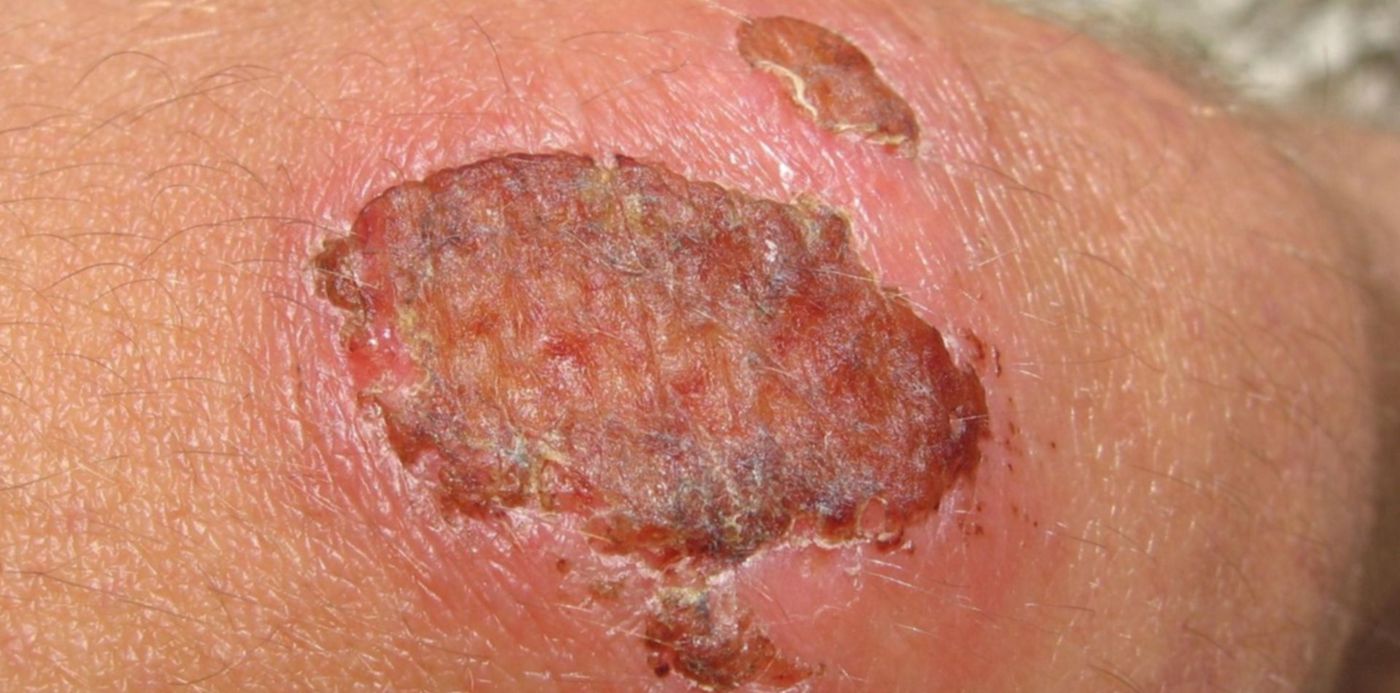 1542802079085.jpg?rotate=0&scaleX=1&oh=1125&y=173&height=741&scaleY=1&ow=1500&x=11&width=1481&&cw=1920&ch=950