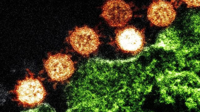 un estudio revelo cual es el factor de riesgo mas asociado a las muertes por coronavirus