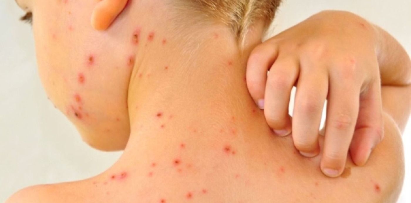 1594388827720.jpg?x= 40&y=70&width=1573&height=786&rotate=0&scaleX=1&scaleY=1&ow=1500&oh=999&&cw=1920&ch=950