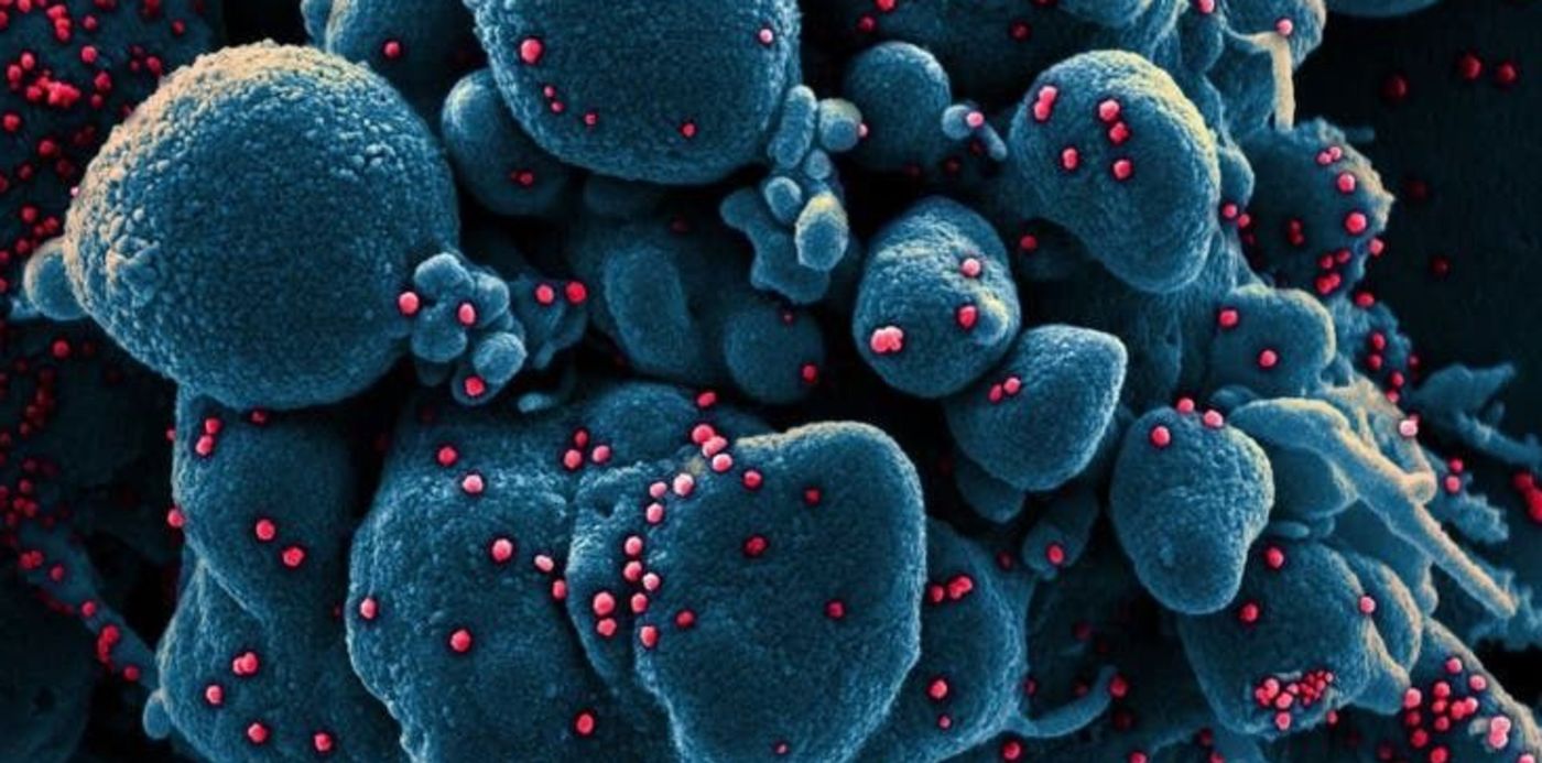 1585265848742.jpg?x=3&y=74&width=733&height=367&rotate=0&scaleY=1&scaleX=1&ow=740&oh=493&&cw=1920&ch=950