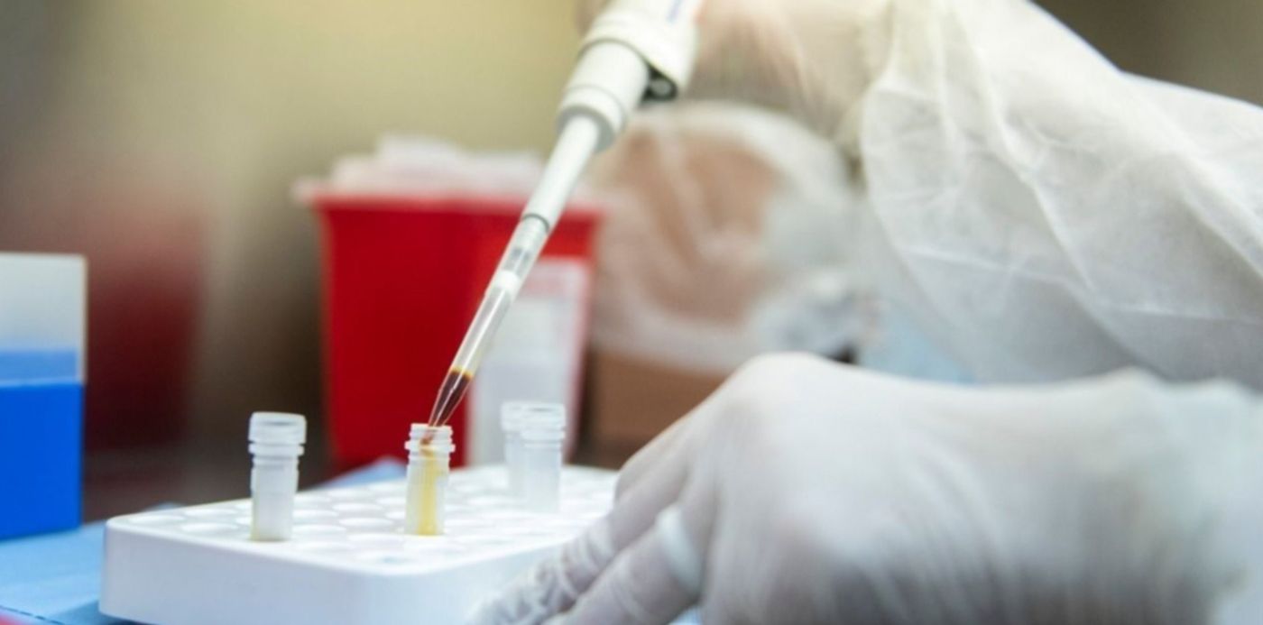 1585839940529.jpg?x=11&y=103&width=1258&height=629&rotate=0&scaleX=1&scaleY=1&ow=1280&oh=799&&cw=1920&ch=950