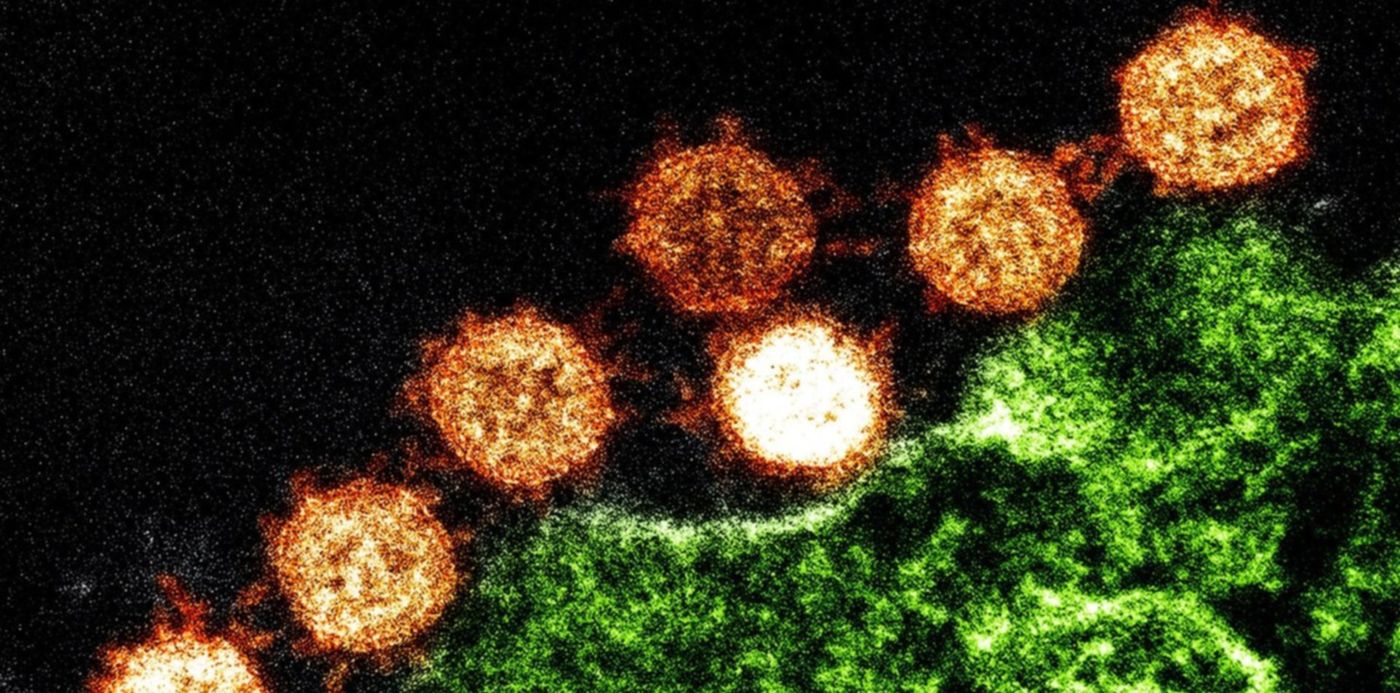 1580068416397.jpg?x=7&y=43&width=1486&height=743&rotate=0&scaleX=1&scaleY=1&ow=1500&oh=999&&cw=1920&ch=950