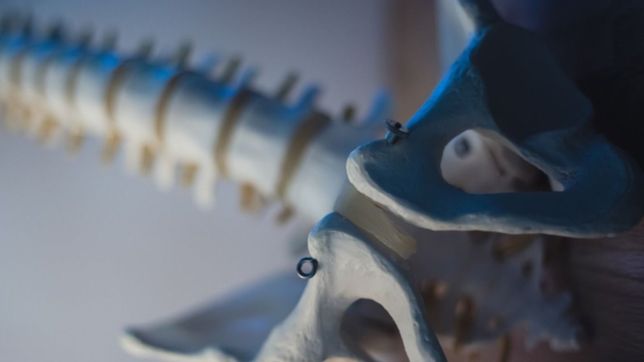 una docente de la unlp fabrico una columna 3d para una operacion en el hospital de ninos