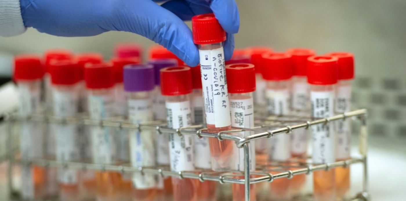 1585424745790.jpeg?scaleY=1&oh=968&y=94&width=1484&height=742&rotate=0&x=8&scaleX=1&ow=1500&&cw=1920&ch=950