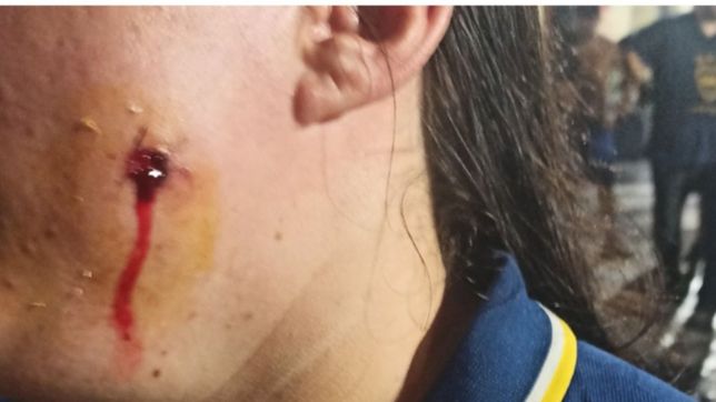 videos: balas de goma, gases y pelea entre hinchas de boca y la policia en uno