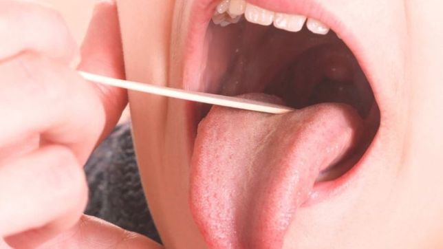 bacteria streptococcus pyogenes: ¿cuales son los sintomas y como es el tratamiento?