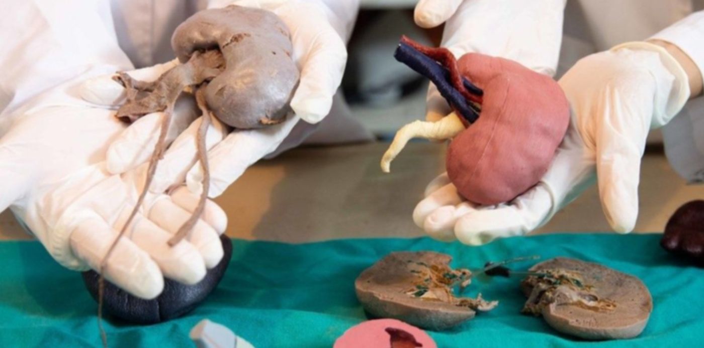 1594762970375.jpg?x=2&y=153&width=954&height=477&rotate=0&scaleX=1&scaleY=1&ow=960&oh=640&&cw=1920&ch=950