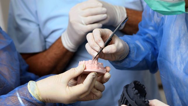 con impresion 3d, la unlp mejora el ajuste de coronas dentales para hacerlas mas duraderas y funcionales