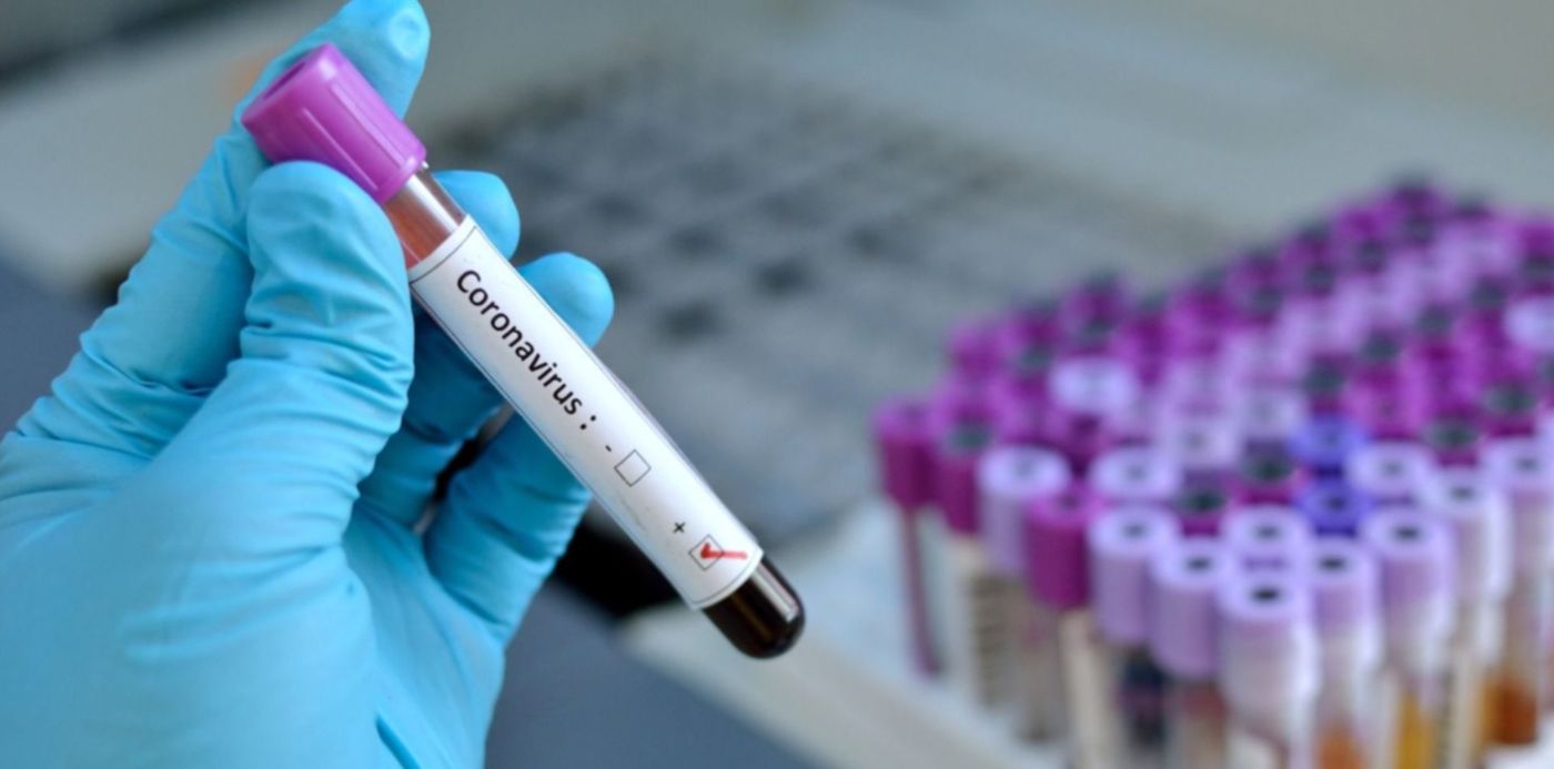 1584104954298.jpg?oh=849&y=17&rotate=0&scaleX=1&scaleY=1&ow=1500&x=8&width=1489&height=744&&cw=1920&ch=950