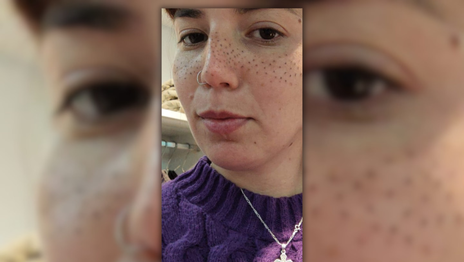 La dura carta de la joven de La Plata que pidió que le resalten las pecas y terminaron arruinándole la cara