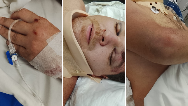 internaron en grave estado al joven atacado por dos motochorros