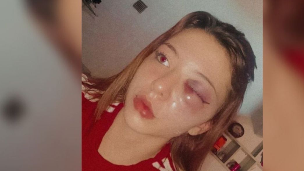 Motochorros atacaron brutalmente a una joven para robarle la mochila en La Plata