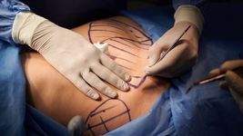 arranco el juicio por el caso de la silvina luna platense que busca probar una mala praxis medica arranco el juicio por el caso de la silvina luna platense que busca probar una mala praxis medica