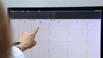 Expertos de la UNLP buscan mejorar los marcapasos implantables